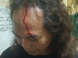 Tragedi Berdarah di Tambangboyo!!!, Advokat Senior Dihantam 'Roti Kalung' Saat Tasyakuran, Polisi Didesak Terapkan Pasal Penganiayaan Berencana